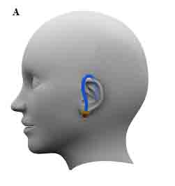 Possible concept for the ear mounted hydration monitoring device. 