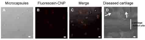 Microcapsules (A) encapsulated with fluorescein labelled CNP (B). Image in (C) is merged. Inflammatory explant model shows presence of CNP containing microcapsules (white arrows) released from the cartilage defect site (D). White bars represent 2 ?M. 
