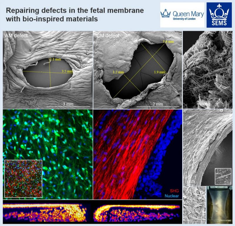 Repairing defects in foetal membrane