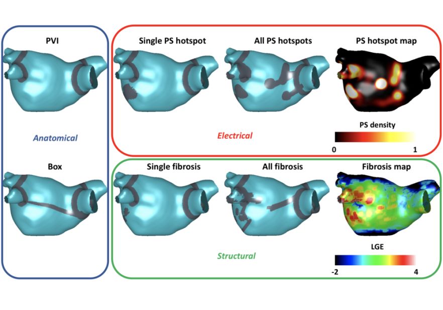 Ablation Approaches