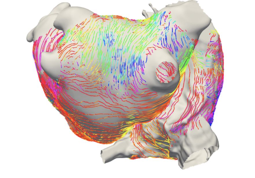 Atrial Fibres