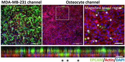 Cancer cells (green) invading into bone cell (red) channel of chip