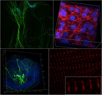 Clockwise, from top left: keratinocytes deforming protein nanosheets on top of an oil droplet (Gautrot lab), fibroblasts forming a network in a hydrogel (S.Lopategui, Iskratsch lab), cardiomyocytes contracting soft polymers (with titin doublets resolved at approximately 160nm distance, I.Xanthis, Iskratsch lab) and flat worm larvaes (A.Carrillo-Baltodano, Martin lab, SBCS), all imaged with the Nikon SoRa super-resolution spinning disc microscope