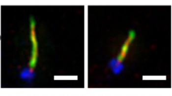 Super resolution microscopy images of chondrocyte primary cilia showing the reduction in cilia length in an expanded cell (right) compared to a freshly isolated cell (left). The scale bars are 2 microns.