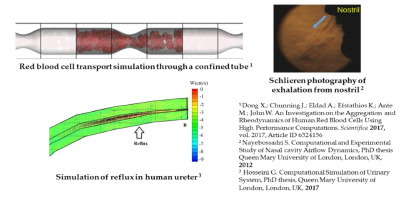 Illustrations of CFD red blood cell and urinary flows, and Schlieren imaging for exhalation from human nostril