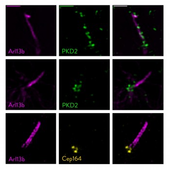 Super resolution microscopy images of polycystin-2 and primary cilia