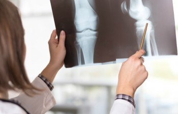 New generation of synthetic bone grafts created