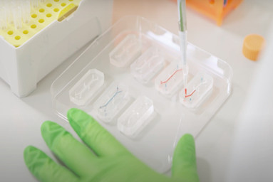 Prof Hazel Screen featured on The Guardian podcast