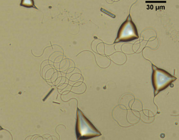 Droplets with tail-like filaments. Credit: Emily Lin.