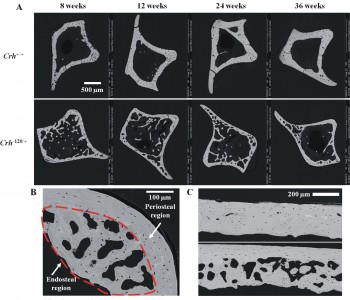 Changes in bone quality in steroid-induced osteoporosis.