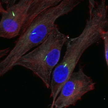 Confocal microscopy image of primary cilia labelled green in a sample of cells (nuclei labelled blue)