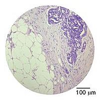 Exciting New Paper on the Tumour Microenvironment