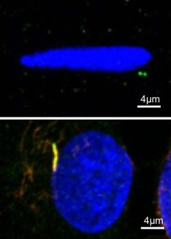 Confocal microscopy images showing tendon cells with primary cilia. Top image is a cell within tendon tissue. Bottom image is an isolated tendon cell growing in vitro. Nucleus labelled in blue, primary cilia labelled with acetylated alpha tubulin (red)