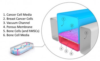 Simplified schematic of the proposed organ-chip model of bone metastasis incorporating relevant cell populations in a 3D tumour matrix environment.