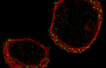 This photo shows cells adhering to large nanopatterns. The green dots indicate the sites of adhesions, and the red area shows where molecules responsible for contracting the cells are located.