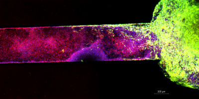 Development of an on-chip model for glioma published