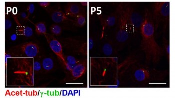 Confocal images showing loss of cilia associated with cell expansion and dedifferentiation. The left image shows freshly isolated cells cultured for 6 days (Passage 0). The right image shows expanded cells (Passage 5).