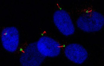 This confocal microscopy image shows cilia (in red) are the thin hair-like structures only a few 100th of a millimetre long.