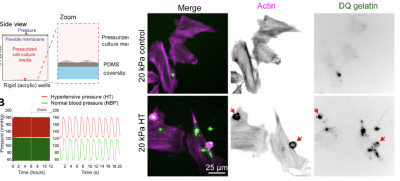 VSMC Mechanosensing