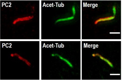 Super resolution microscopy images of polycystin2 labelled on primary cilia