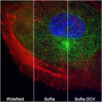 Comparison of widefield image, SoRa raw image with approximately 1.4x improvement, and deconvolved (DCV) SoRa image with approximately 2x improvement resulting in an XY resolution down to 120nm (with permission from Nikon)