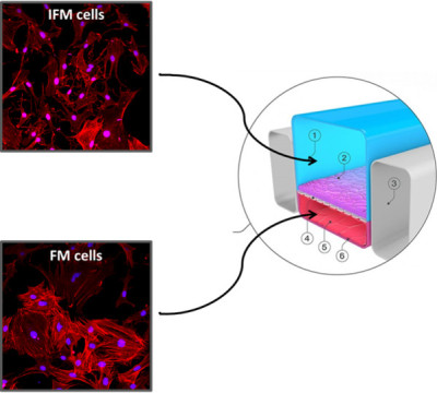 IFM cells