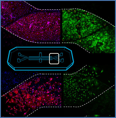 Queen Mary researchers awarded MRC funding to develop human tendon-on-a-chip …