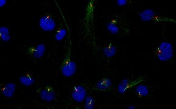 Changing stem cell structure may help fight obesity
