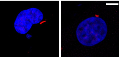 Confocal microscopy image of cartilage cells treated with the YAP agonist LPA (right) showing reductions in the length of primary cilia (red) associated with prevention of inflammation and cartilage degradation. https://doi.org/10.1016/j.joca.2022.11.001