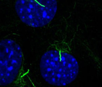 click/tap to enlarge this image... confocal microscopy image of primary cilia stained green