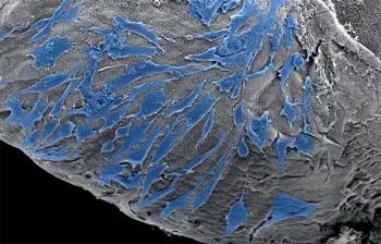 Cells spreading on the outside of a scaffold