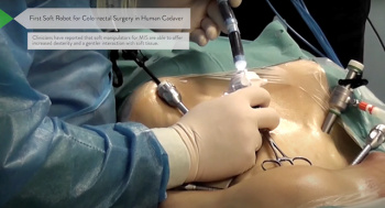 First soft robot for colo-rectal surgery in human cadaver. [credit: STIFF-FLOP]