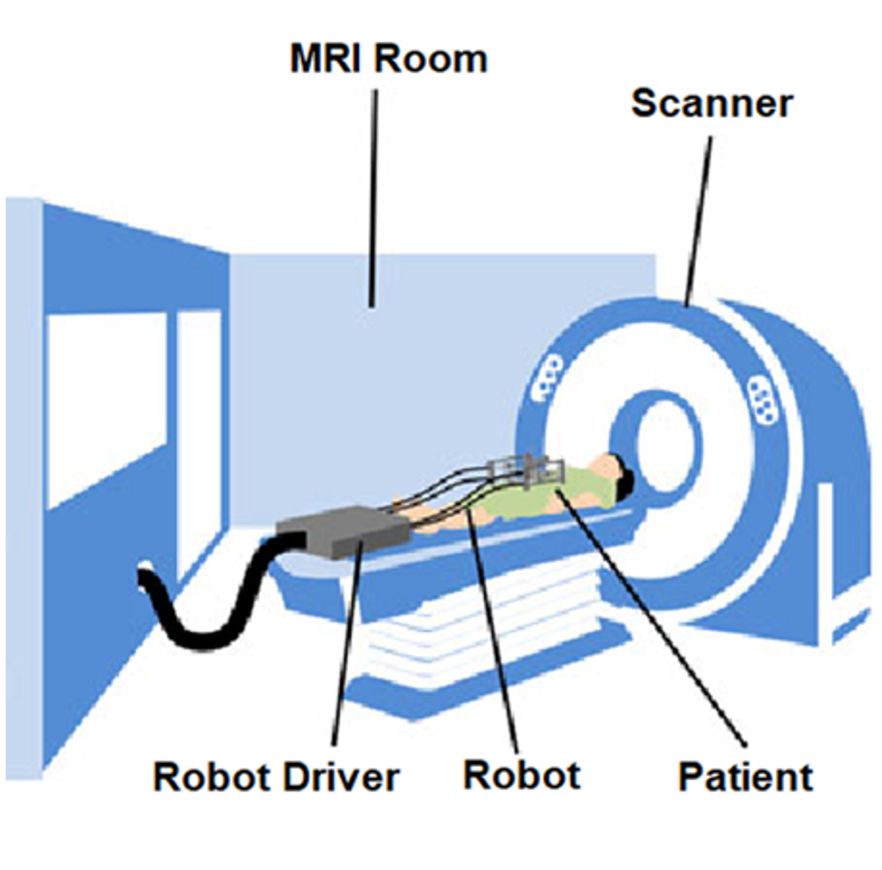 MRI
