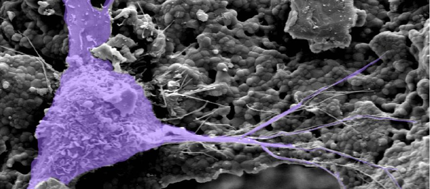 Human Bone Cell on Inductigraft