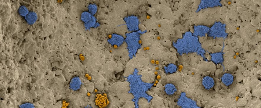 Synthetic Bone Graft Substitute Granule  