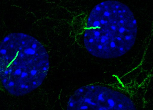 Primary Cilia