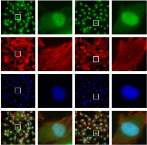 Epifluorescence images of YAP (green) and Actin (red)