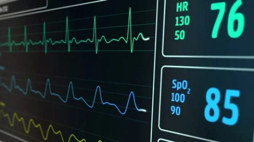 Electrocardiogram (ECG) and Oxygen Saturation level (SpO2) physiological signals.