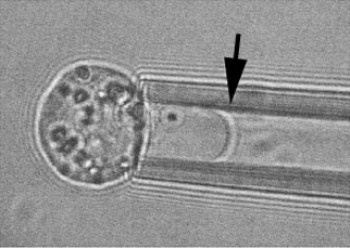 Micropipette aspiration of a living stem cell