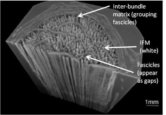 A microCT image showing the IFM (white) between fascicles (unstained)