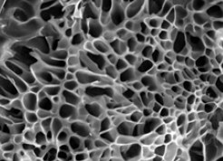 Microstructure of hydrogels