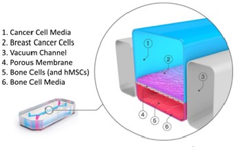 Proposed Emulate bone metastasis organ-chip