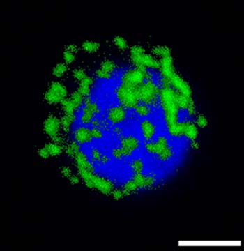 Confocal time lapse images showing a single cell attaching to a material surface.  The cell has been transfected with eGFP-actin to enable visualisation of the actin cytoskeleton.