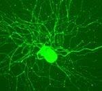 Isolated neuron immunolabelled for NF200