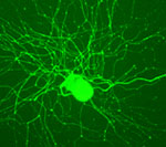 Isolated neuron immunolabelled for NF200