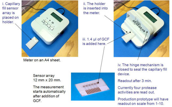 Prototype meter and capillary fill sensor array developed for monitoring periodontal disease by measuring four protease activities in gingival crevicular fluid (GCF).
