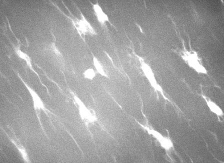 Image of interstitial cells within the heart valve showing how they inconnect with long cell processes