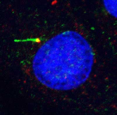 primary cilia and basal body labelled with antibodies to acetylated tubulin (green) and pericentrin (red) respectively. Nucleus labelled with Hoescht 33342 (blue)