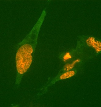 Osteoblast like cells co-stained for Runx-2