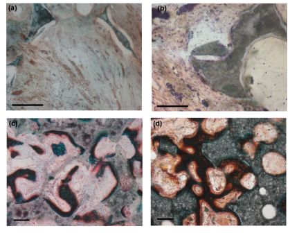 Figure 1	(a) Vascular penetration into macroporosity of PSA02 scaffold (b) association of cells and capillaries with scaffold struts (PSA08), morphology of ingrowth within peripheral region of (c) PSA02 and (d) PSA08 scaffolds at 1 week. Bar = 100 um.